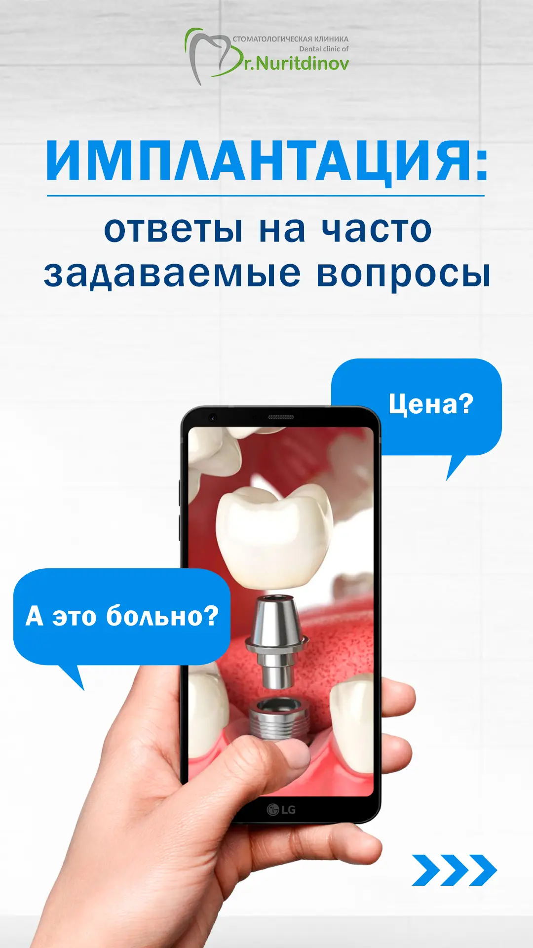 Имплантация